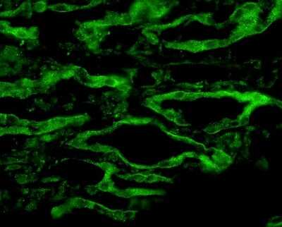 Immunohistochemistry: Aquaporin-4 Antibody [NBP1-97928]